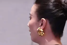 43岁宋佳近照！腋下副乳明显，真空礼服险走光，胳膊上痕迹引热议图片