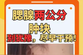 腮腺两公分肿块，质地硬，别犹豫，尽早干预！图片