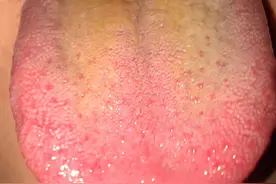 爱出汗的朋友注意了，你流的不是汗，而是阳气，教你一招锁住阳气图片