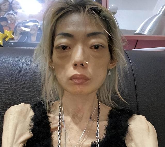 豪门玩物，几年被折磨成牙齿全脱落，不足80斤，似骷髅，惨不忍睹