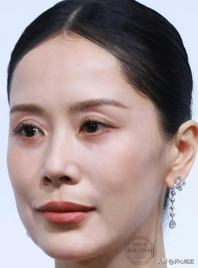 天哪47岁的海清脸上打了多少针啊，肿成奶白馒头，全是医美痕迹