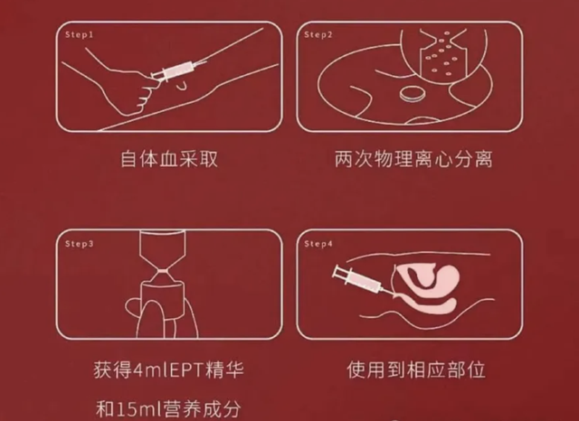 “高潮针”预约爆满：一针上万，谁在把‘性解放’变成天价智商税