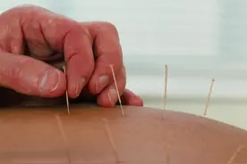 腰椎间盘突出不用愁，中医针灸有妙招图片