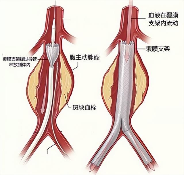 岁数大不能剪指甲？医生频繁强调：55岁以后，剪指甲 “4不要”