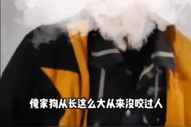 离谱！男子电梯被狗咬了一口，女子：我家狗从小到大来不咬人图片