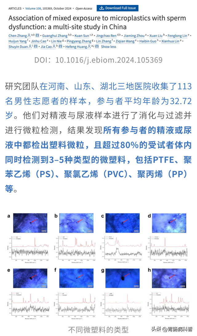 复旦大学新研究：微塑料不粘锅或损害生育力！还诱发帕金森！