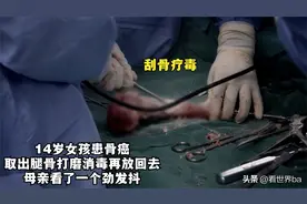 14岁女孩患骨癌，取出腿骨打磨消毒再放回去，母亲看了一个劲发抖图片