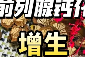 前列腺增生并钙化，7味排石化钙。图片