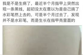 温馨提醒：指甲出现这个变化，可能是癌变！别不当回事！图片
