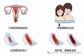 没有这5个症状，你已经转阴了，别再怀疑HPV感染！图片