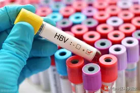 省钱又放心的乙肝定期检查，查什么，如何查？医生说出答案图片