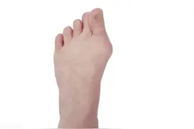 左脚大拇指关节肿痛的原因是什么图片