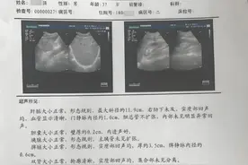 乙肝复查，这几项就够了，不仅能够全面了解病情，还少花冤枉钱！图片