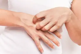 汗疱疹又痒又疼反复难愈？多半是体内有毒！3个办法有效缓解图片