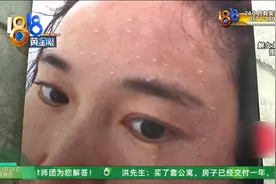 恶心呕吐、掉头发、眼睛刺痛、脱皮，上班第八天，她才找到原因图片