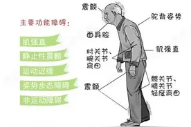 如何通过日常锻炼改善手抖？图片
