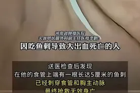 震惊！河南29岁男子卡鱼刺，土方喝醋吃米饭缓解，第二天抢救无效图片