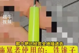 触目惊心！女孩被铁锥子扎数百下，居然未达到霸凌标准，网友炸锅图片