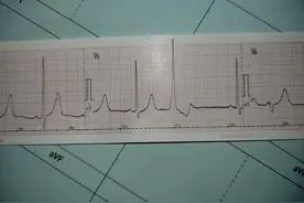 一个专治心慌、心悸的中成药！图片