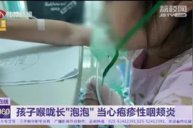 暑期高发! 孩子喉咙长泡泡当心疱疹性咽峡炎图片