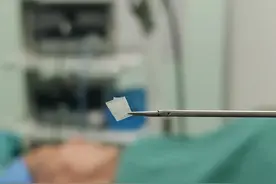 武汉男子掏耳朵致鼓膜穿孔，专家巧用蒜皮贴补耳伤图片