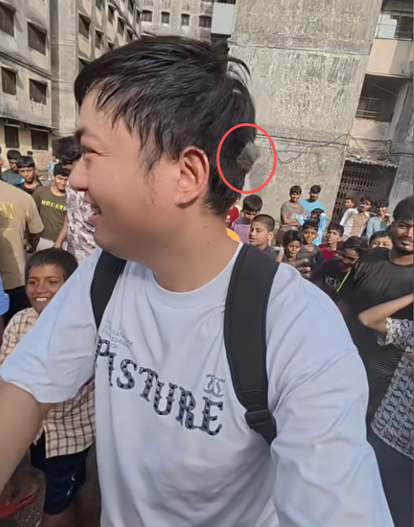 中国夫妻探秘印度贫民窟：丈夫被石头砸满头包，妻子一直被打臀部