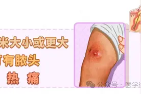 身上长了个很大的痘痘，红肿疼痛，是疖子吗？图片