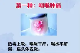 堪称中医界的抗生素——六神丸，居然能治疗这6种疾病！图片