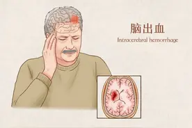 上厕所时突发脑出血，罪魁祸首竟然是它！医生提醒：日常做好4件事，别让厕所成为家里最要命的地方！图片