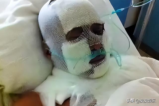 因拒绝给伴舞签名被害到毁容，沦落到卖马桶谋生，如今他过得咋样