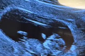 47岁女星洪小铃怀孕后仍持续爬山五六个月，运动过度导致胎位下降！医生紧急提醒：或引发早产风险图片