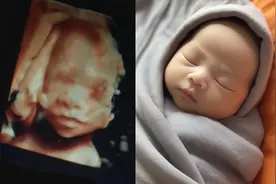 四维照片能预测小孩出生后长相？AI真会玩......图片