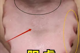 男人最怕的三种舌象：阳虚、精亏、湿热重！个个都是男性健康杀手图片