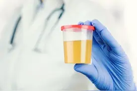 一位泌尿外科医生对尿常规的见解图片