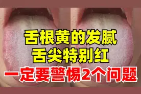 潘大夫舌诊：舌根黄的发腻，舌尖红的出奇，一定警惕这两个问题！图片
