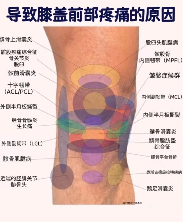 如果你膝盖疼医生会做哪些检查?会查出哪些病?