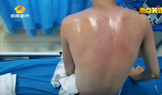“去趟水上乐园,中招妇科病”:水上乐园的水有多脏?