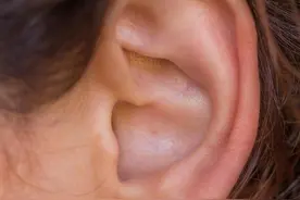 耳洞里臭臭的，耳朵爱长痘？都是因为它没做好！图片
