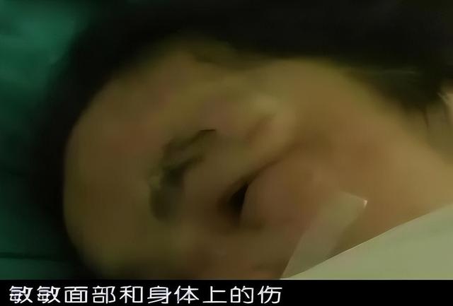人狠起来究竟有多可怕？15岁女孩受虐5年，被利器撬掉所有牙齿！