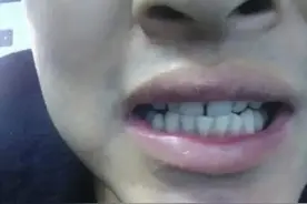 “上门牙有缝，处处硝烟盛”，什么意思，老一辈的话有道理吗图片