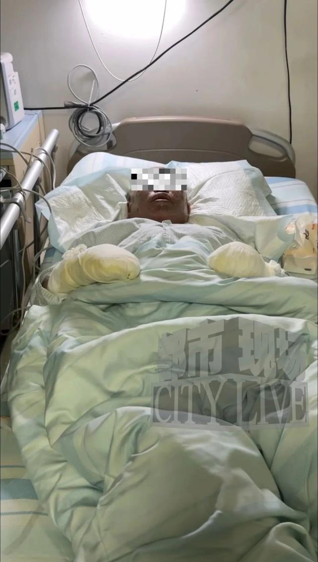 就差这10分钟！温州一出租屋突然爆炸，女子全身烧伤，丈夫因去买苹果躲过一劫