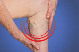 站起来腿部血管就会突出明显是什么原因图片