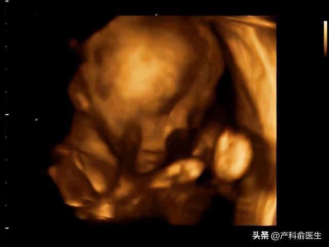 怀孕6个月：宝宝长到30厘米，听得见妈妈的声音啦。