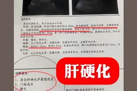 希望你的肝脏彩超,永远别出现这5点图片