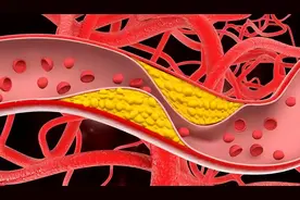不论男女，头部若出现7种异常，多半是血管堵了，尽早就医图片