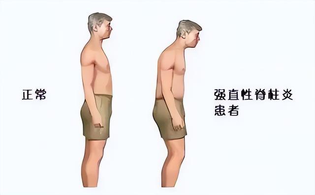 身价上亿有什么用？37岁患“不死癌症”的李宇春，给所有人提了醒