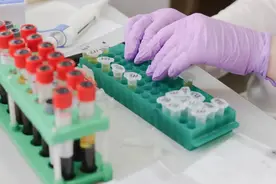 儿童化验超敏crp高就一定是细菌感染吗？很多人都犯错图片