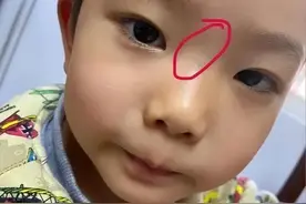 孩子脾虚积食，脸不会说谎！3种表现说明脾虚超过3个月图片