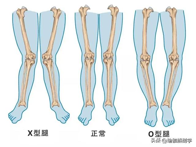 每天这样躺着抬腿100次，瘦腿效果杠杠滴，腿又细又直还不伤膝盖