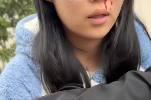 “小姐姐牵绳遛狗被一家人围殴	，邻居帮忙作证也被打伤！打人男子还扬言要杀狗…”警方调取监控，已立案